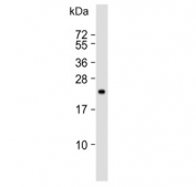 Western blot testing of human SW480 cell lysate with TIMP2 antibody. Predicted molecular weight ~24 kDa.