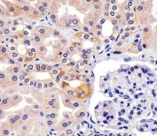 IHC testing of FFPE human kidney tissue with TIMP2 antibody. HIER: steam section in pH6 citrate buffer for 20 min and allow to cool prior to staining.
