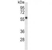 Western blot testing of human HepG2 cell lysate with FADS2 antibody. Predicted molecular weight ~52 kDa.