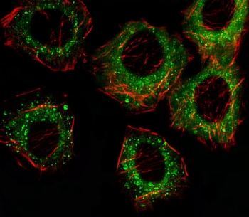 Immunofluorescent staining of fixed and permeabilized human A549 cells with FADS2 antibody (green) and anti-Actin (red).