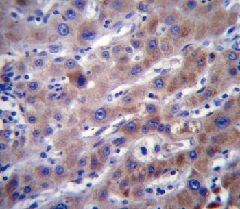 IHC testing of FFPE human liver tissue with FADS2 antibody. HIER: steam section in pH6 citrate buffer for 20 min and allow to cool prior to staining.