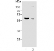 Western blot testing of human 1) breast and 2) liver lysate with FADS2 antibody. Predicted molecular weight ~52 kDa.