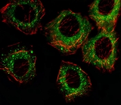 Immunofluorescent staining of fixed and permeabilized human A549 cells with FADS2 antibody (green) and anti-Actin (red).