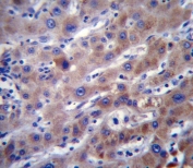 IHC testing of FFPE human liver tissue with FADS2 antibody. HIER: steam section in pH6 citrate buffer for 20 min and allow to cool prior to staining.