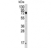 Western blot testing of mouse liver cell lysate with HSPA5 antibody. Predicted molecular weight: ~73 kDa, but routinely observed at 70-78 kDa.
