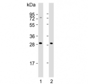Western blot testing of human 1) K562 and 2) HepG2 cell lysate with NKG2A antibody. Predicted molecular weight: 26-40 kDa depending on glycosylation level.
