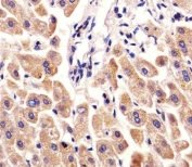 IHC testing of FFPE human liver tissue with Fetuin-A antibody. HIER: steam section in pH6 citrate buffer for 20 min and allow to cool prior to staining.