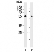 Western blot testing of human 1) blood plasma and 2) liver lysate with AHSG antibody. Predicted molecular weight: ~39/45-59 kDa (unmodified/glycosylated).