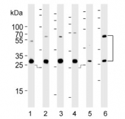 Western blot testing of human 1) A431, 2) HeLa, 3) HepG2, 4) HT-1080, 5) placenta and 6) kidney lysate with Cathepsin A antibody. Expected molecular weight: ~54 kDa precursor, 32 kDa (large subunit).
