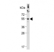 Western blot testing of human HEK293 cell lysate with Cathepsin A antibody. Expected molecular weight: ~54 kDa precursor, 32 kDa (large subunit).