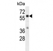 Western blot testing of mouse bladder lysate with Cathepsin A antibody. Expected molecular weight: ~54 kDa precursor, 32 kDa (large subunit).