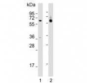 Western blot testing of human 1) SW620 and 2) liver lysate with Carboxylesterase 2 antibody. Predicted molecular weight ~62 kDa.