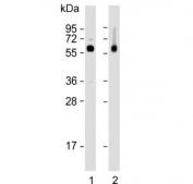 Western blot testing of human 1) HepG2 and 2) liver lysate with Carboxylesterase 2 antibody. Predicted molecular weight ~62 kDa.