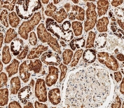 IHC testing of FFPE human kidney tissue with BCKDHB antibody. HIER: steam section in pH6 citrate buffer for 20 min and allow to cool prior to staining.