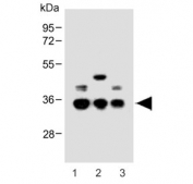Western blot testing of human 1) HeLa, 2) Jurkat and 3) Daudi cell lysate with BCKDHB antibody. Predicted molecular weight: ~43 kDa, observed molecular weight: ~35 kDa.