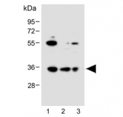 Western blot testing of human 1) HeLa, 2) 293T and 3) Jurkat cell lysate with BCKDHB antibody. Predicted molecular weight: ~43 kDa, observed molecular weight: ~35 kDa.