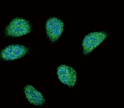 Immunofluorescent staining of fixed and permeabilized human 293 cells with SERPINA6 antibody (green) and DAPI nuclear stain (blue).