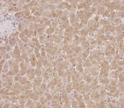 IHC testing of FFPE human liver tissue with SERPINA6 antibody. HIER: steam section in pH6 citrate buffer for 20 min and allow to cool prior to staining.
