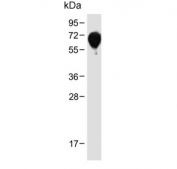 Western blot testing of human plasma lysate with SERPINA6 antibody. Expected molecular weight: ~45/50-60 kDa (unmodified/glycosylated).