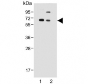 Western blot testing of human 1) T-47D and 2) HepG2 lysate with SERPINA6 antibody. Expected molecular weight: ~45/50-60 kDa (unmodified/glycosylated).