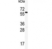 Western blot testing of mouse spleen lysate with HDAC2 antibody. Predicted molecular weight: 55-60 kDa.