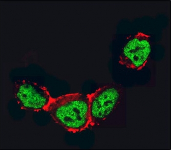 Immunofluorescent staining of fixed and permeabilized human 293 cells with HDAC2 antibody (green) and anti-Actin (red).