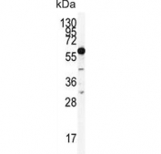 Western blot testing of human 293 cell lysate with HDAC2 antibody. Predicted molecular weight: 55-60 kDa.