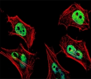 Immunofluorescent staining of fixed and permeabilized human HeLa cells with HDAC2 antibody (green) and anti-Actin (red).