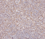 IHC testing of FFPE human spleen tissue with IFITM3 antibody. HIER: steam section in pH6 citrate buffer for 20 min and allow to cool prior to staining.