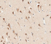 IHC testing of FFPE human brain tissue with AP1M1 antibody. HIER: steam section in pH6 citrate buffer for 20 min and allow to cool prior to staining.