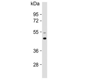 Western blot testing of human brain lysate with AP1M1 antibody. Predicted molecular weight ~49 kDa.