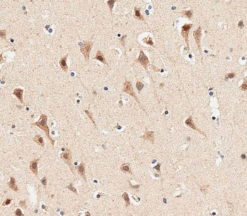 IHC testing of FFPE human brain tissue with AP1M1 antibody. HIER: steam section in pH6 citrate buffer for 20 min and allow to cool prior to staining.