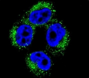 Immunofluorescent staining of fixed and permeabilized human A375 cells with AP1M1 antibody (green) and DAPI nuclear stain (blue).
