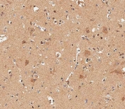 IHC testing of FFPE human brain tissue with DLL3 antibody. HIER: steam section in pH6 citrate buffer for 20 min and allow to cool prior to staining.