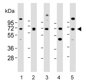 Western blot testing of human 1) 293, 2) A549, 3) brain, 4) SH-SY5Y and 5) U-2 OS lysate with DLL3 antibody. Predicted molecular weight: ~65 kDa.