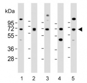 Western blot testing of human 1) 293, 2) A549, 3) brain, 4) SH-SY5Y and 5) U-2 OS lysate with DLL3 antibody. Predicted molecular weight: ~65 kDa.
