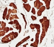 IHC testing of FFPE human skeletal muscle tissue with MCT4 antibody. HIER: steam section in pH6 citrate buffer for 20 min and allow to cool prior to staining.