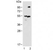 Western blot testing of 1) human skeletal muscle and 2) rat skeletal muscle lysate with MCT4 antibody. Predicted molecular weight ~50 kDa.
