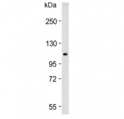 Western blot testing of human placenta lysate with GAA antibody. Predicted molecular weight ~105 kDa.