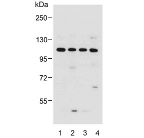 Western blot testing of human 1) HeLa, 2) MCF7, 3) SW620 and 4) A549 cell lysate with GAA antibody. Predicted molecular weight ~105 kDa.