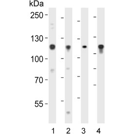 Western blot testing of human 1) A549, 2) MCF7, 3) SW620 and 4) PC-3 cell lysate with GAA antibody. Predicted molecular weight ~105 kDa.