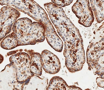 IHC testing of FFPE human placenta tissue with GAA antibody. HIER: steam section in pH6 citrate buffer for 20 min and allow to cool prior to staining.