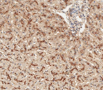 IHC testing of FFPE human liver tissue with GAA antibody. HIER: steam section in pH6 citrate buffer for 20 min and allow to cool prior to staining.