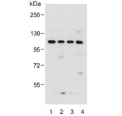 Western blot testing of human 1) HeLa, 2) MCF7, 3) SW620 and 4) A549 cell lysate with GAA antibody. Predicted molecular weight ~105 kDa.
