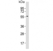 Western blot testing of mouse eyeball lysate with Cytokeratin 12 antibody. Predicted molecular weight ~54 kDa.