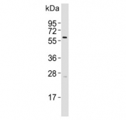 Western blot testing of human Y79 cell lysate with Cytokeratin 12 antibody. Predicted molecular weight ~54 kDa.