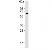 Western blot testing of rat eyeball lysate with Cytokeratin 12 antibody. Predicted molecular weight ~54 kDa.
