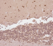 IHC testing of FFPE human cerebellum tissue with ELAVL2 antibody. HIER: steam section in pH6 citrate buffer for 20 min and allow to cool prior to staining.