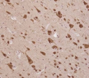 IHC testing of FFPE human brain tissue with ELAVL2 antibody. HIER: steam section in pH6 citrate buffer for 20 min and allow to cool prior to staining.