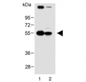 Western blot testing of human 1) HACAT and 2) A431 cell lysate with SGPP1 antibody. Predicted molecular weight ~49 kDa.